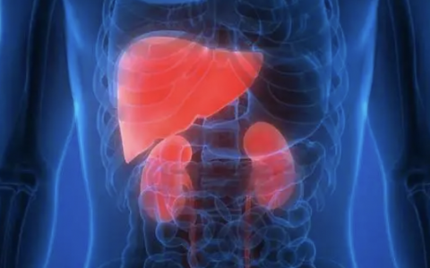 A 56-year-old man with hepatorenal syndrome（肝肾综合征）