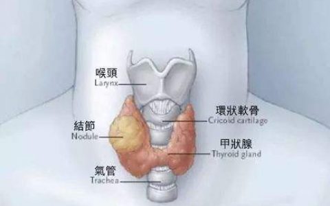 A 34-year-old woman with  vomiting, tremulous, and diaphoretic