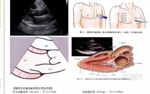 心脏超声常见切面介绍