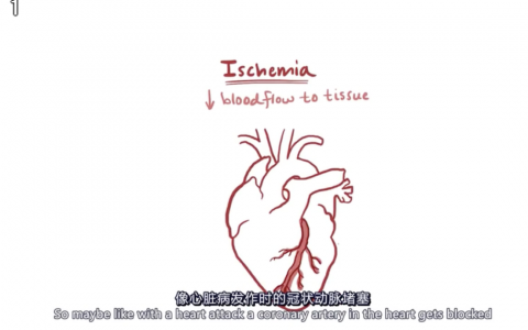 【Osmosis】休克（shock）