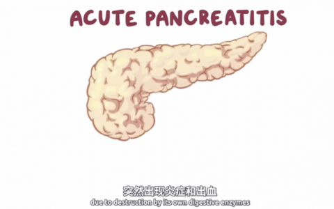 【Osmosis医学】急性胰腺炎