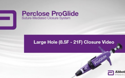 雅培ProGlide血管缝合器