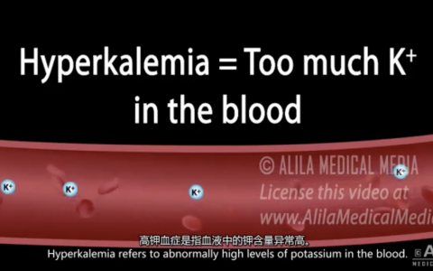 高钾血症的成因、心电图及治疗