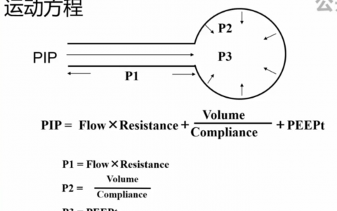 容量控制通气下的气道高压报警