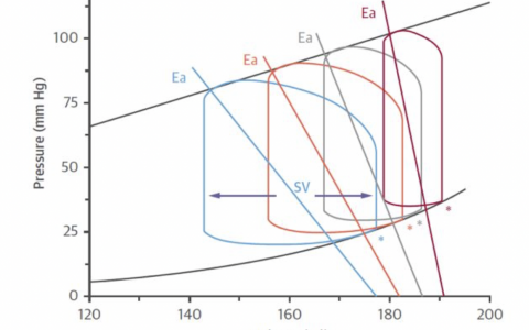 听老李讲ECMO第七讲_ECMO平流问题