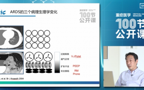 ARDS患者如何进行肺复张