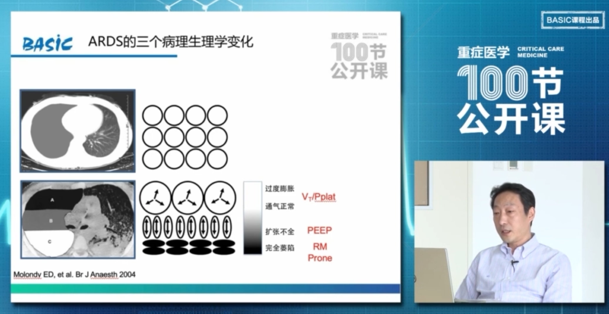 ARDS患者如何进行肺复张