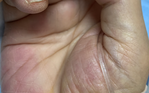 看图识病_2021.6.15