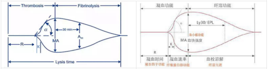 血栓弹力图