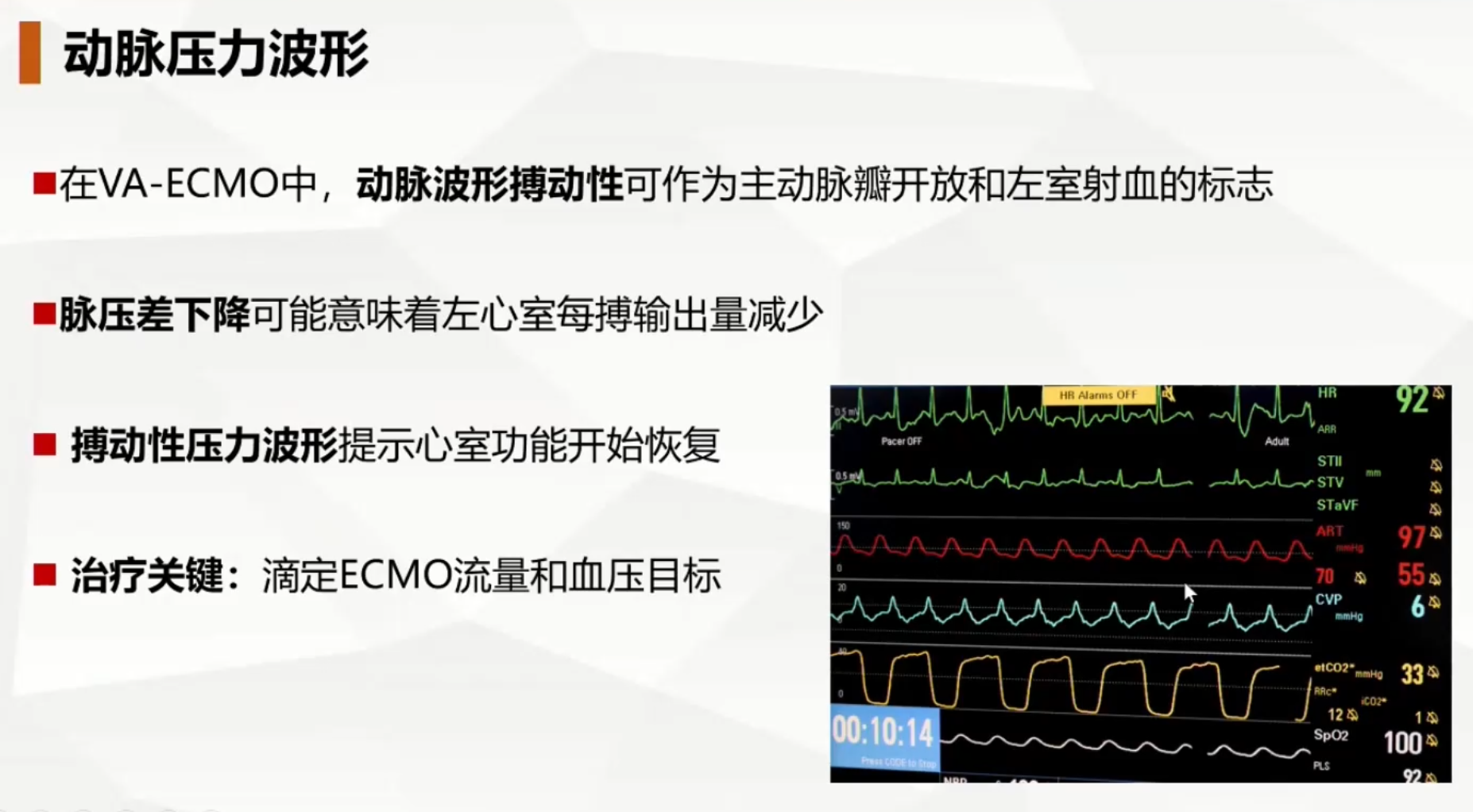 ECMO理论培训系列网课_ECMO循环支持和血流动力学管理