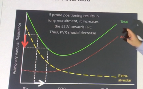 ARDS俯卧位通气对血流动力学的影响