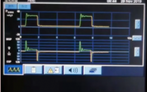 ECMO理论培训系列网课_体外二氧化碳清除
