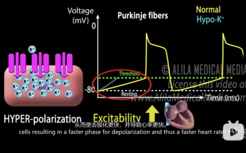 为什么低K容易引起室早？
