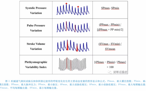 床旁如何获取PPV_协和杜斌