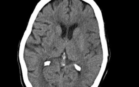 每日一题_2022.1.5