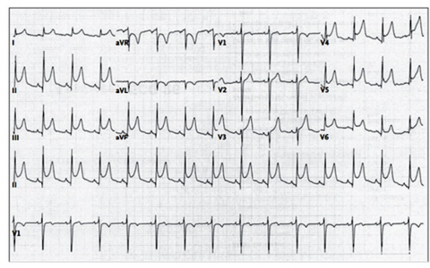 每日一题_2022.1.7