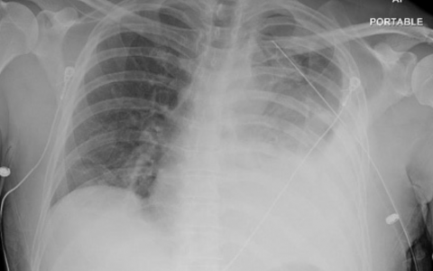 每日一题_2022.1.9