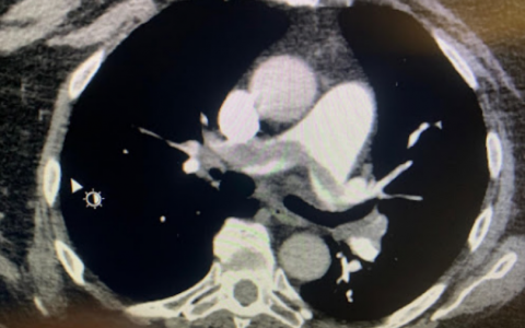 每日一题_2022.1.11