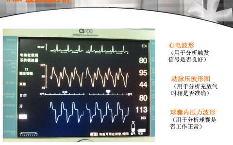每日一题_2022.1.13