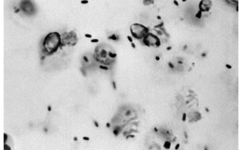 每日一题_2022.1.14