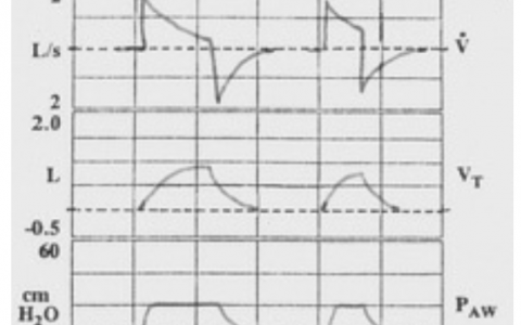 每日一题_2022.1.15