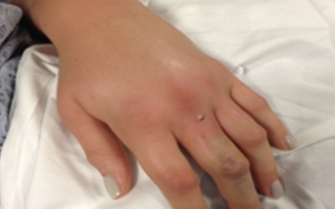 每日一题_2022.1.21