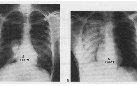 每日一题_2022.1.23