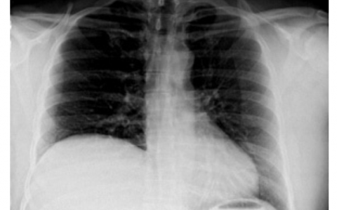 每日一题_2022.1.24