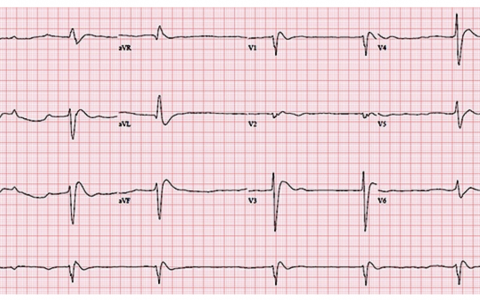 每日一题_2022.1.25