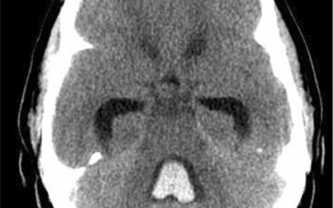 每日一题_2022.1.28