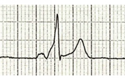 每日一题_2022.1.19