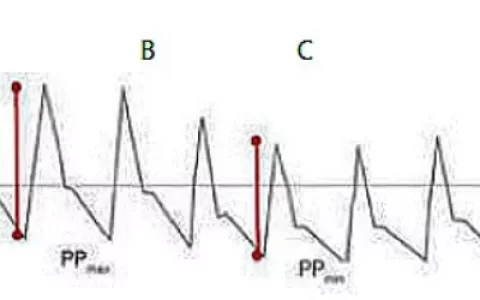 每日一题_2022.1.22