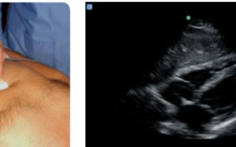 重症知音第4课_超声评估