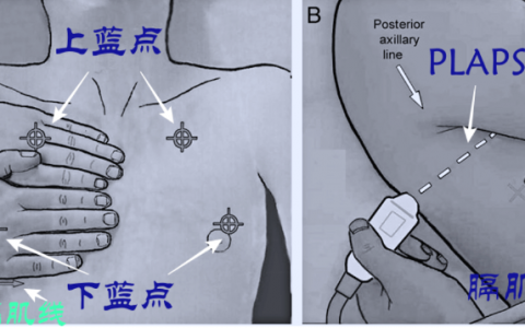 重症知音第5课_超声评估2