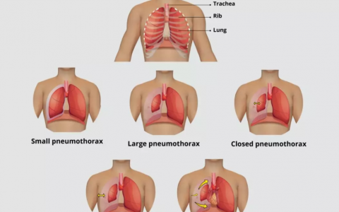 每日一题_2022.1.8
