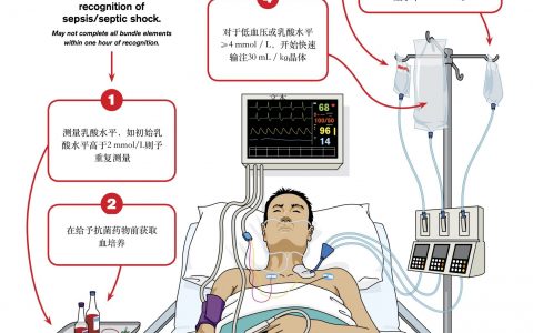 脓毒性休克1小时Bundle