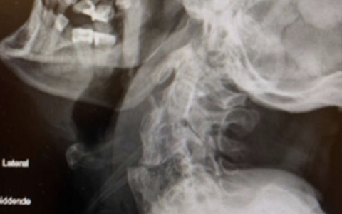 每日一题_2022.2.5