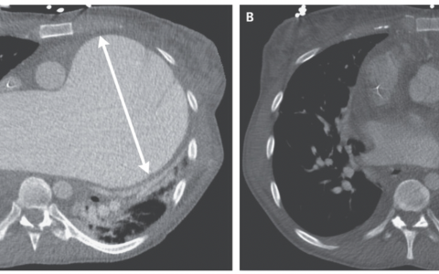 每日一题_2022.2.10