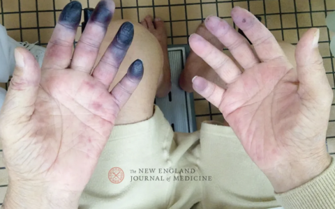 每日一题_2022.2.15