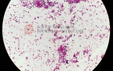 每日一题_2022.2.17