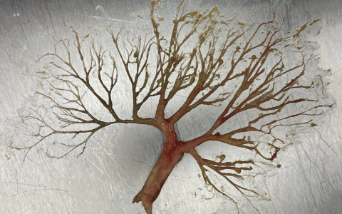 每日一题_2022.2.18