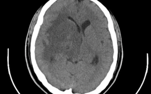 每日一题_2022.2.20