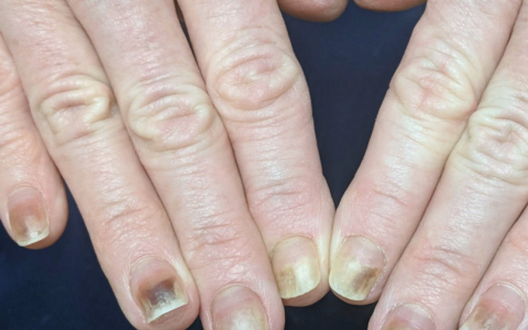 每日一题_2022.2.25