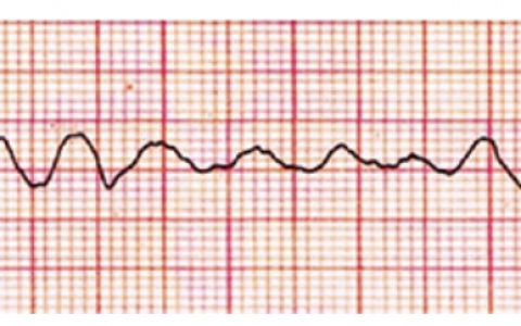 每日一题_2022.2.28
