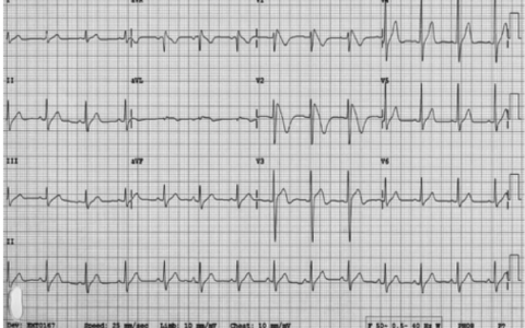 每日一题_2022.3.3
