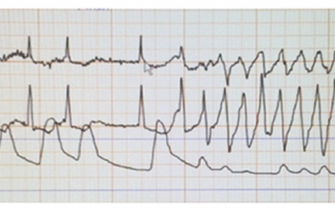 每日一题_2022.3.6