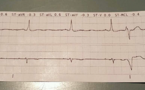 每日一题_2022.3.7