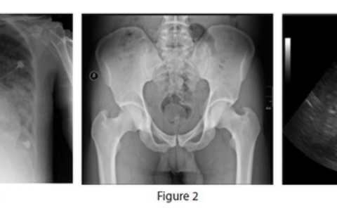 每日一题_2022.3.9