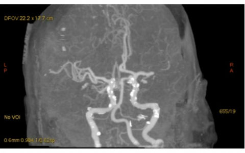 每日一题_2022.3.10