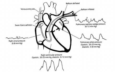 每日一题_2022.3.14